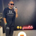 هایلایت ست بگ 🤘